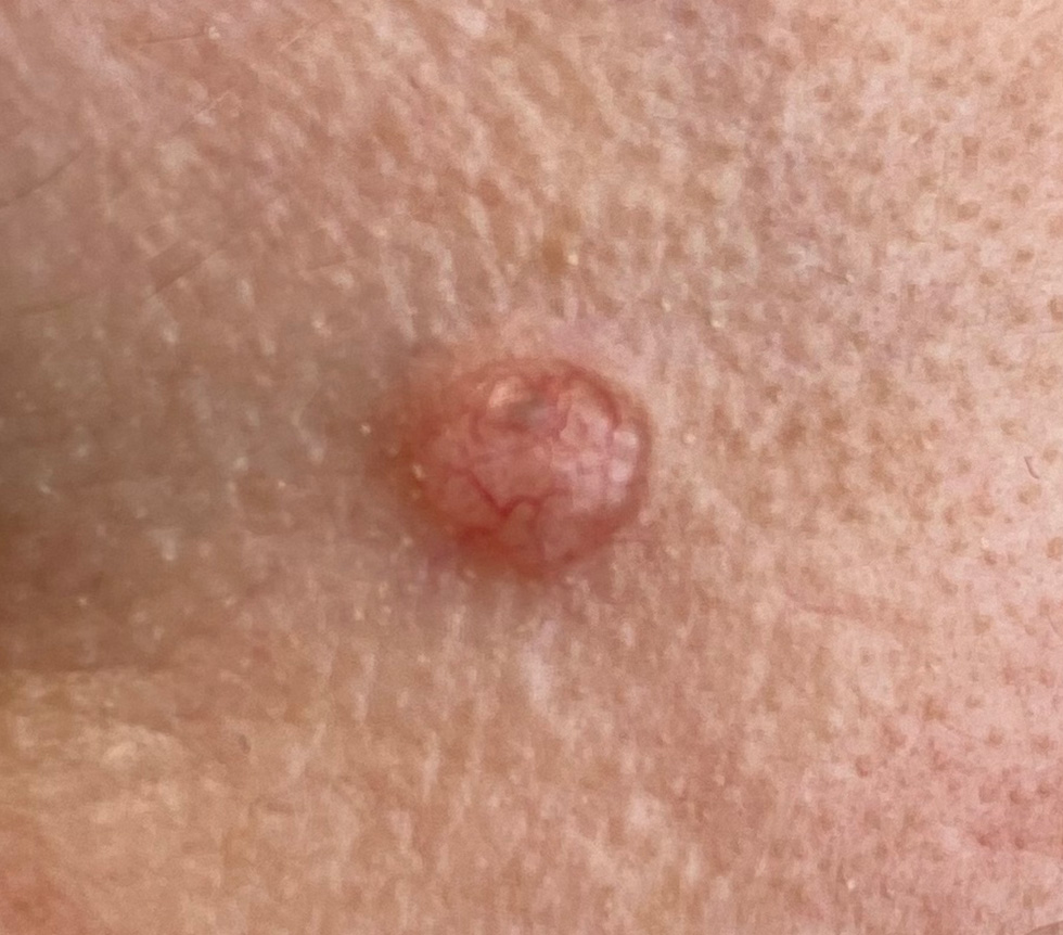 vascular1 skin