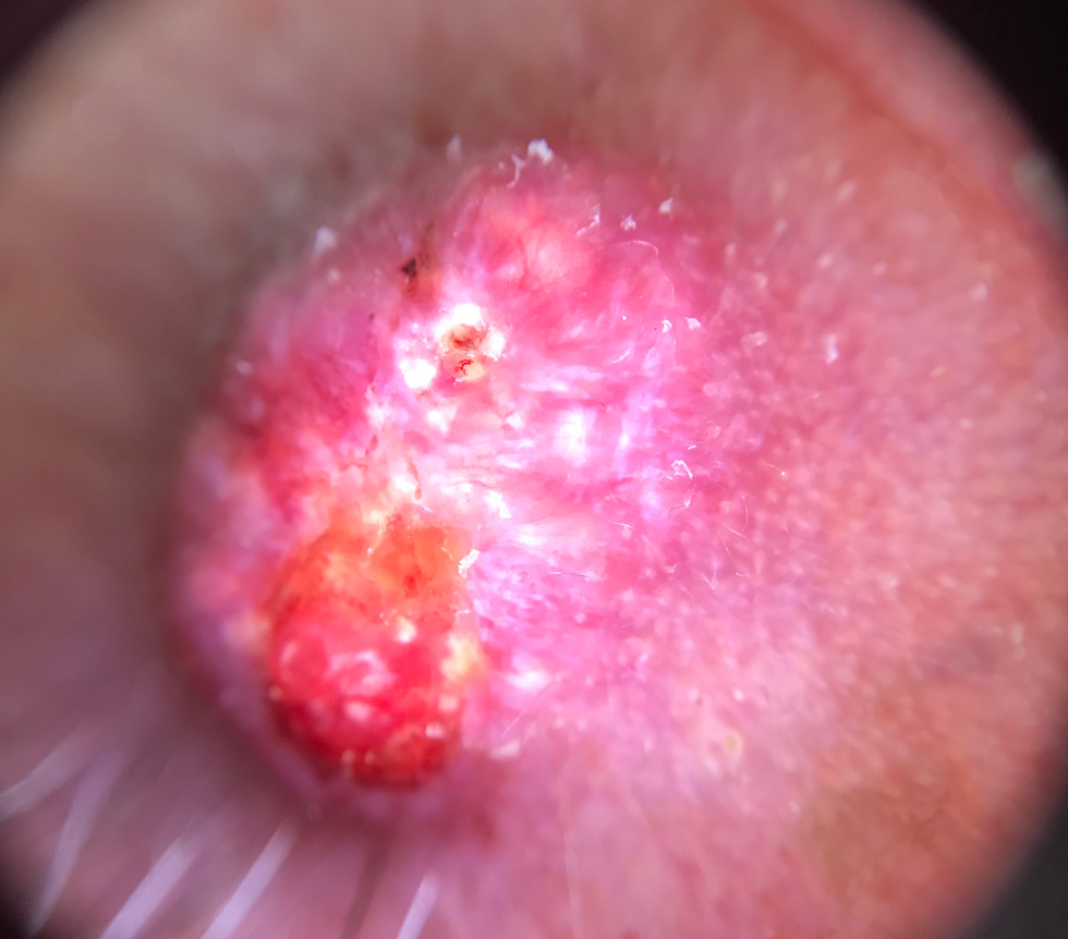 vascular2 skin