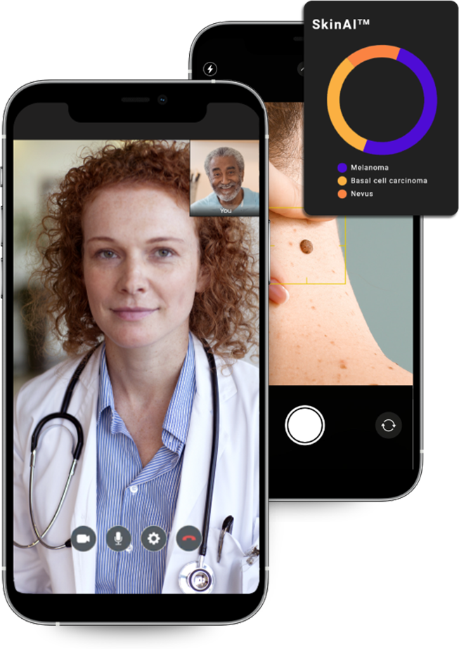 GetSkinHelp-screens Two mobile screens, on one doctor talking to a patient and the other, an Artificial Intelligence (I) analysis of a skin condition