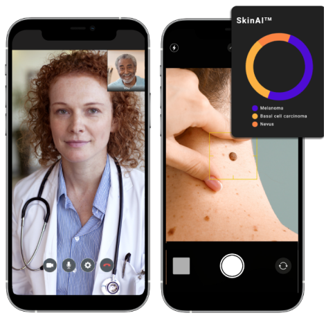 home-help-on-the-go-graphic Two mobile screens, on one doctor talking to a patient and the other, an Artificial Intelligence (I) analysis of a skin condition