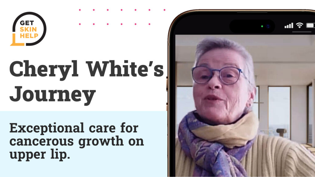 Dr. Hong Patient Story - Cheryl White-GSH blog