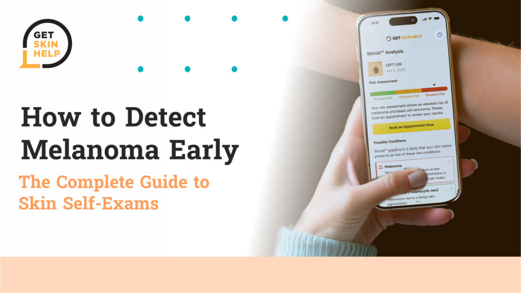 melanoma How to detect skin cancer?