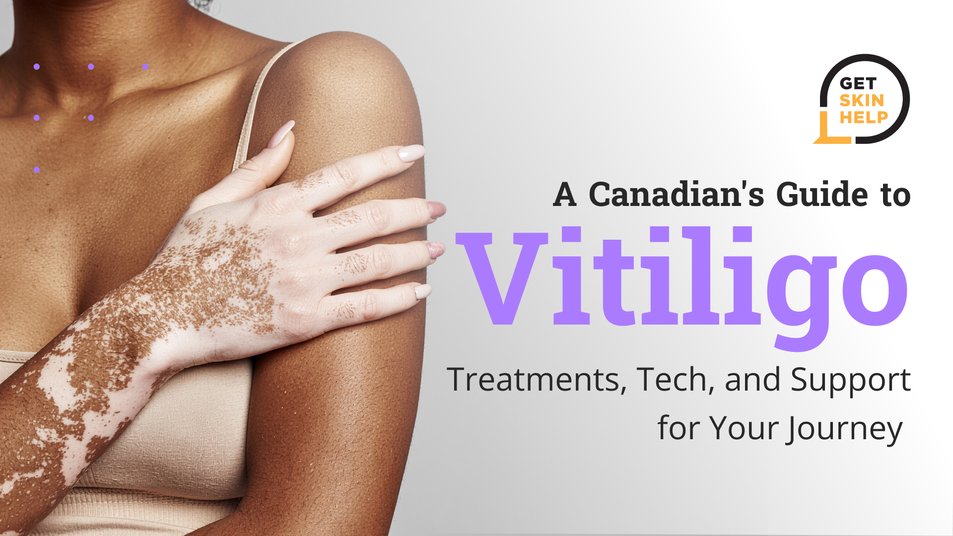 A Canadian's Guide to Vitiligo: Treatments, Tech, and Support for Your Journey