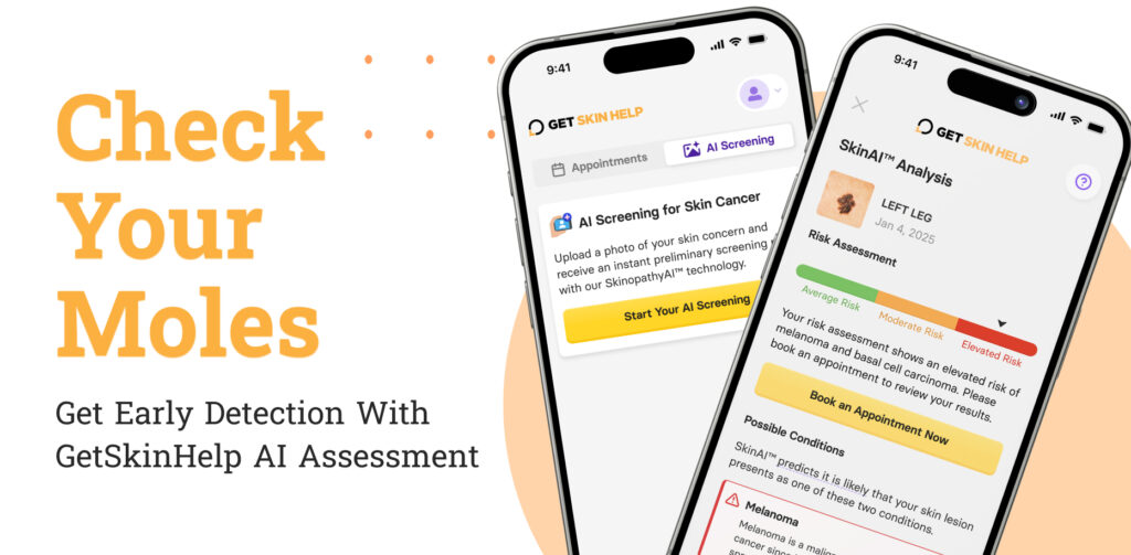 GetSkinHelp: Where Can I Get a Free Skin Cancer Screening?