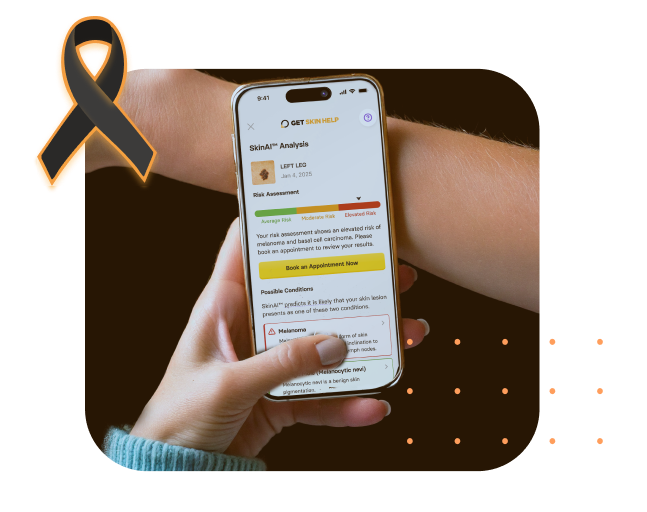 melanoma awareness month