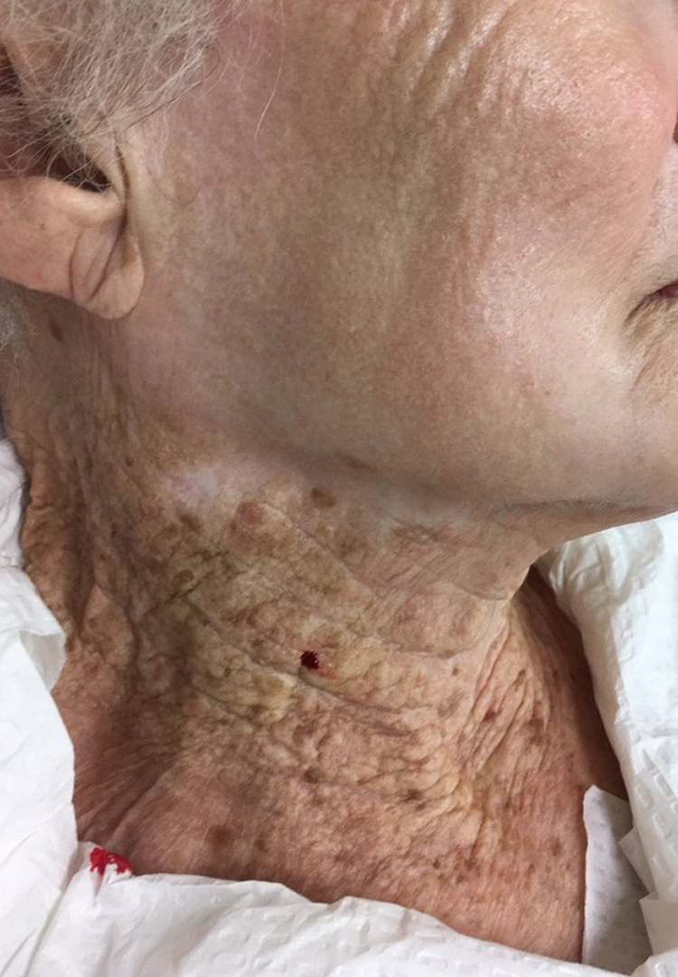What a Viral Sunscreen Photo Means for Ontario Skin Health