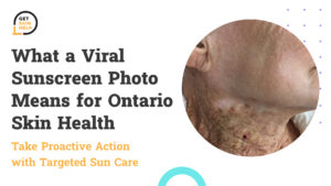 What a Viral Sunscreen Photo Means for Ontario Skin Health